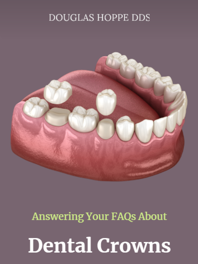 Dental Crowns FAQ